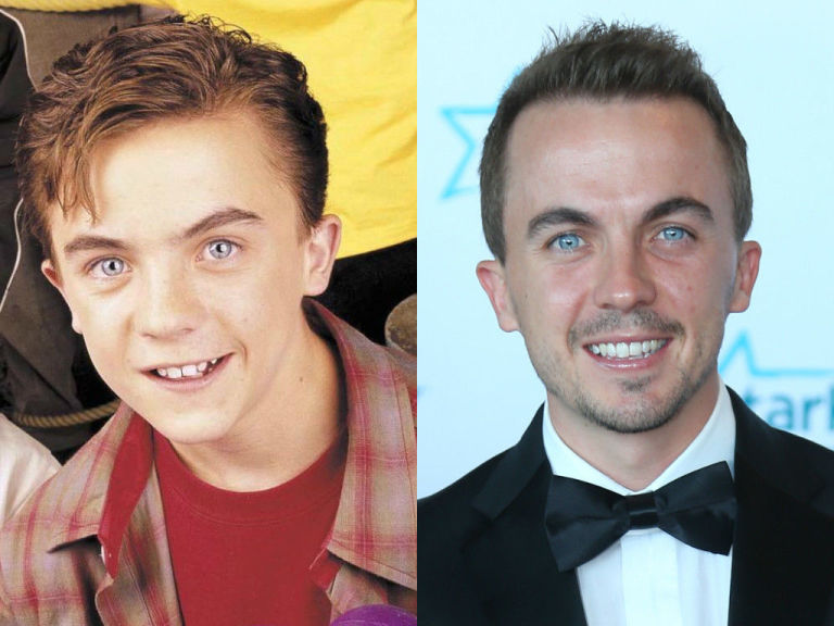 Frankie Muniz non ricorda di essere stato in Malcolm a causa di nove commozioni cerebrali